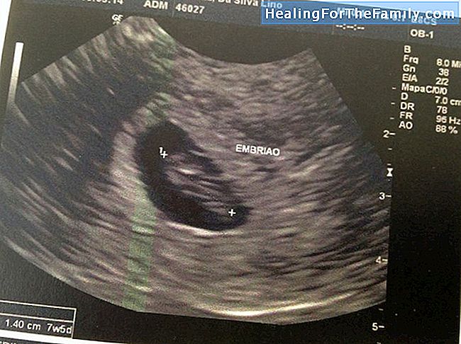 O primeiro ultra-som da gravidez