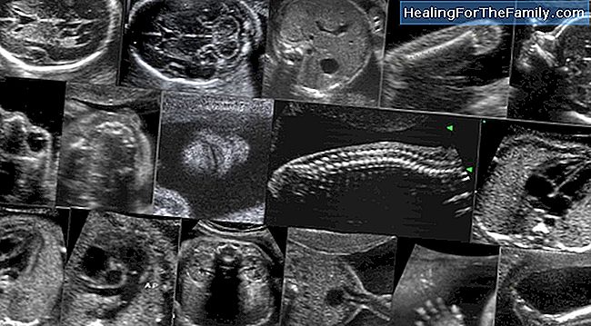 Ultra-sonografia no primeiro trimestre de gravidez