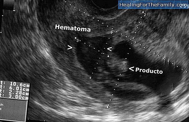 Ultra-sonografia no segundo trimestre da gravidez