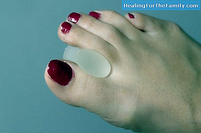 Probleme ortopedice degetele de la picioare de copii