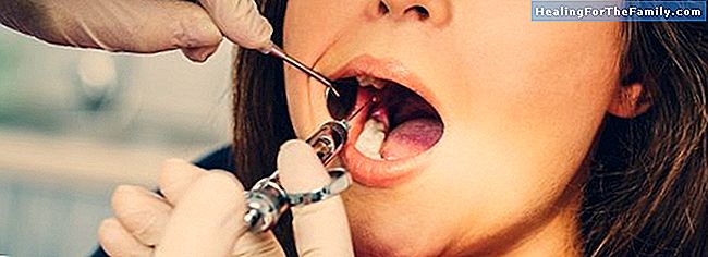 Care sunt tipurile de ortodontie pentru copii