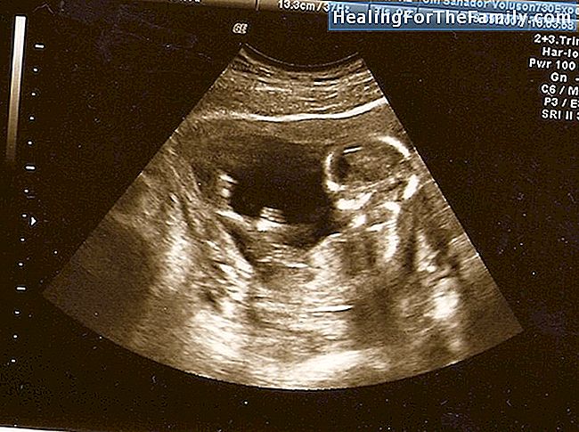Excesul de lichid amniotic în timpul sarcinii