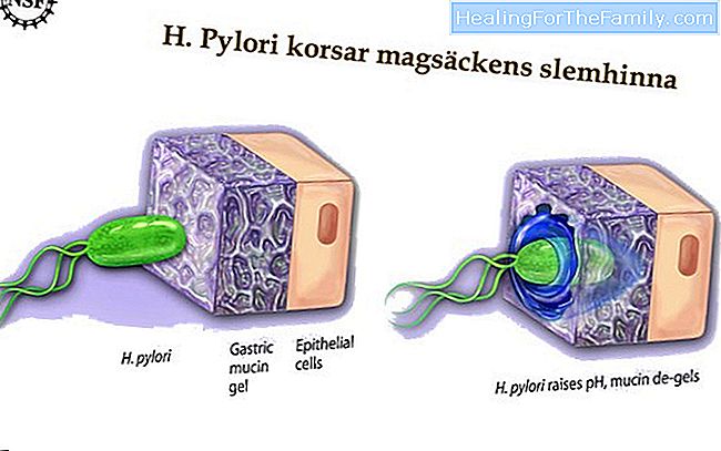 Helicobacter pylori: en mycket vanlig infektion i skolåldern