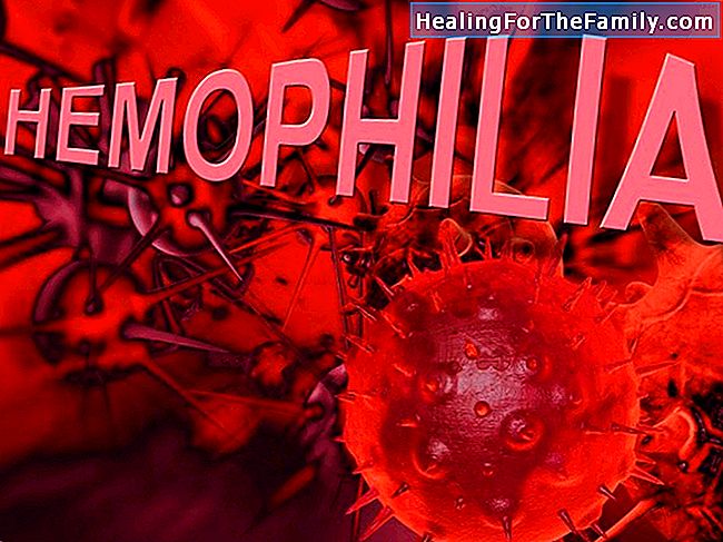 Hemophilia i barndomen