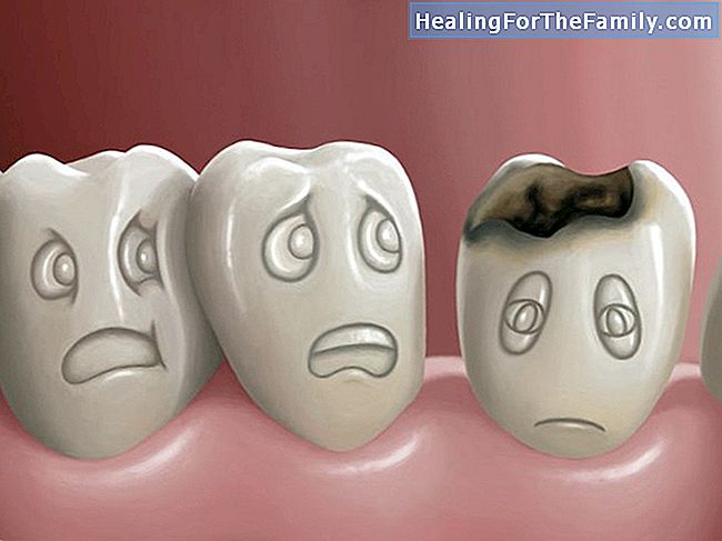 Vad är brytarna på tänderna hos barn