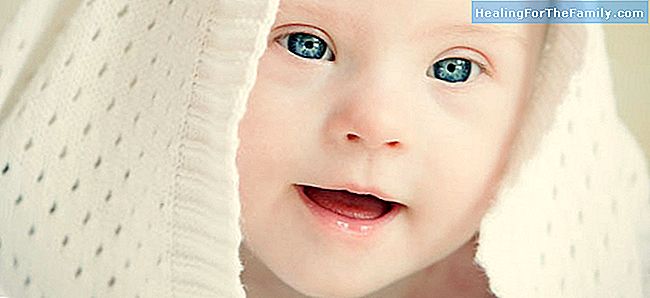 Benefícios do leite materno para bebês com síndrome de Down