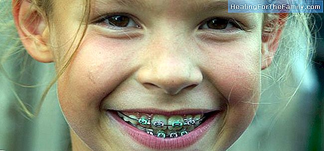 åRsaker til tennene stablet opp barn