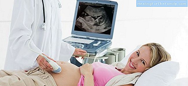 Syndrom: Früherkennung in der Schwangerschaft