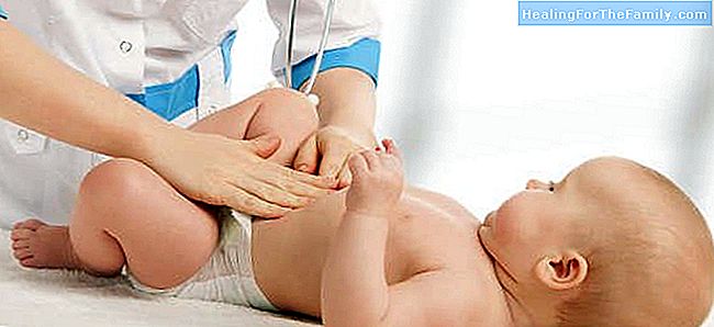 Leistenbruch bei Säuglingen