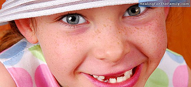 Rautalääkitystä tuottaa tahroja hampaiden lasten