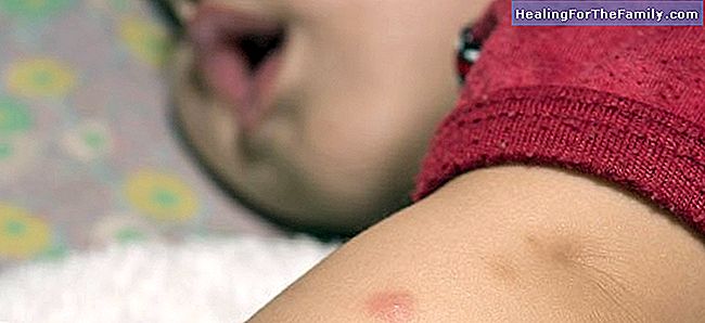 O perigo de mordidas de carrapato em crianças
