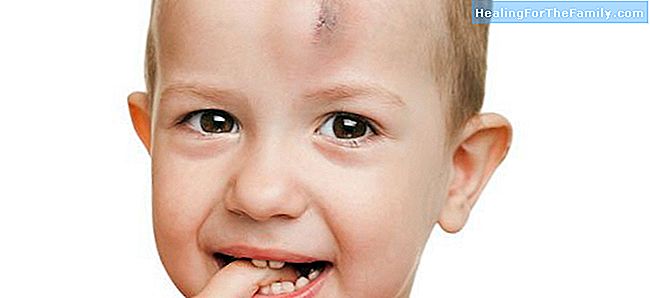 Trois mythes de blessures à la tête chez les enfants
