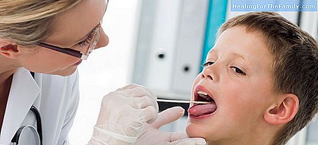 Wat is gingivomatitis. Zwelling van de mond van zuigelingen en kinderen