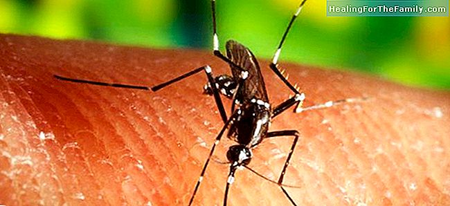 Zika virus aiheuttaa pienipäisyys vastasyntyneille