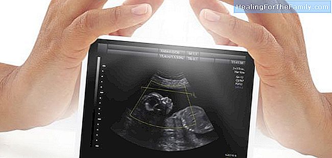 La première échographie de grossesse