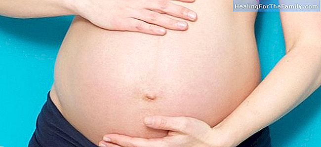 Navelbreuk en zwangerschap